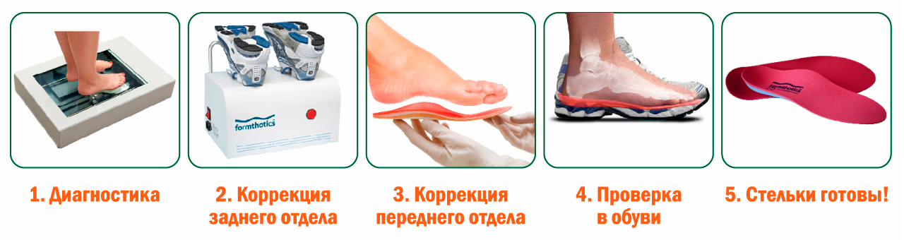 Индивидуальные ортопедические стельки в Москве, изготовление на заказ